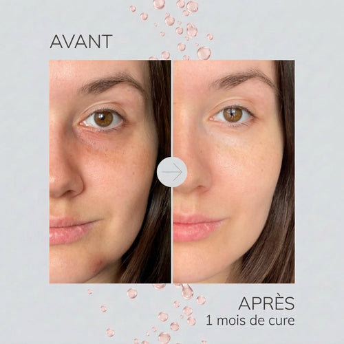 CURE PINK PDRN - 10 jours